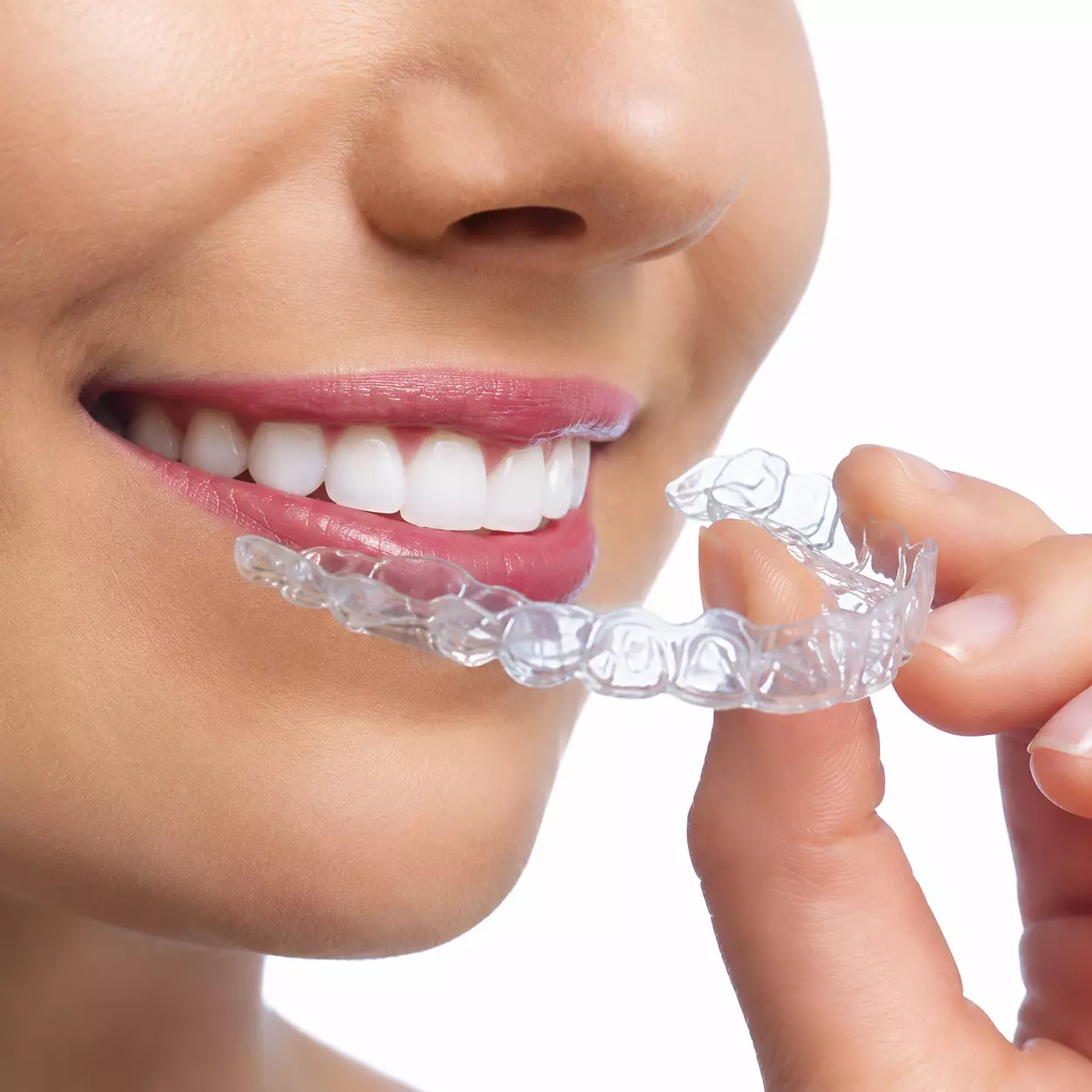Invisalign