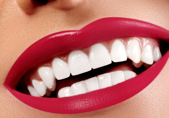 Dental Whitening Oakville